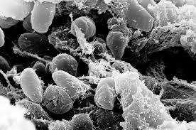 Precaution in part of China after case of bubonic plague Photograph